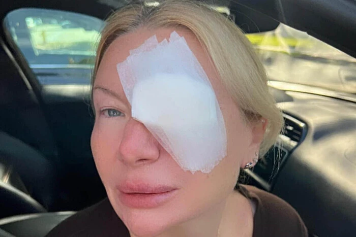 Реалії американської медицини: українка два місяці чекала на операцію з видалення ячменю