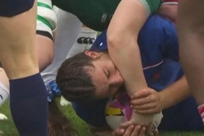 Покусала суперницю. Регбістка збірної Франції пропустить вирішальні матчі Кубка світу