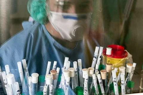 У світі коронавірусом заразилися вже понад 35,4 млн людей