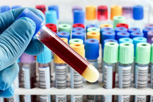 Коронавірус у світі: кількість випадків зараження перевищила 53 мільйони