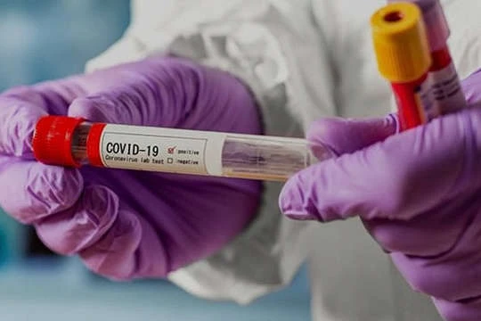 У МОЗ очікують більше 10 тисяч випадків Covid-19 вже завтра