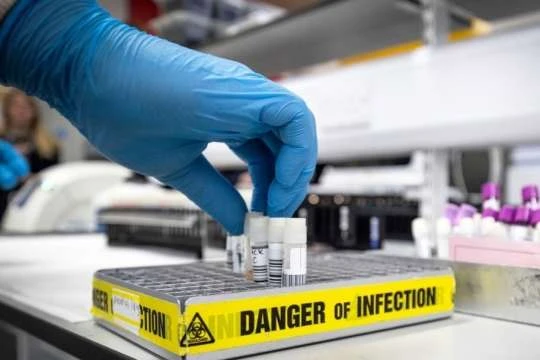 У світі виявили вже понад 37 мільйонів випадків коронавірусу