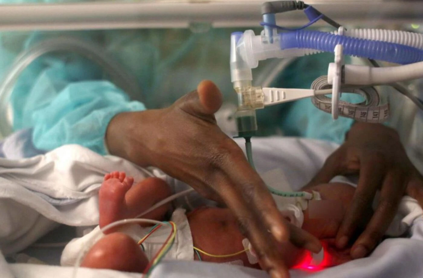 Le retrait américain de nombreux programmes internationaux jugé « dévastateur » pour la santé reproductive dans le monde
