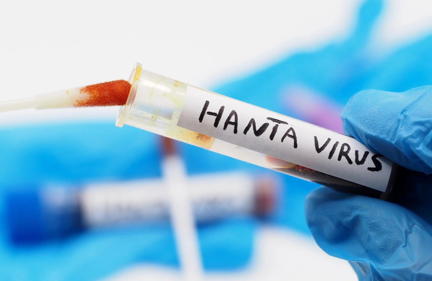 Hantavirus : un Américain testé positif, annonce le ministère de la Santé