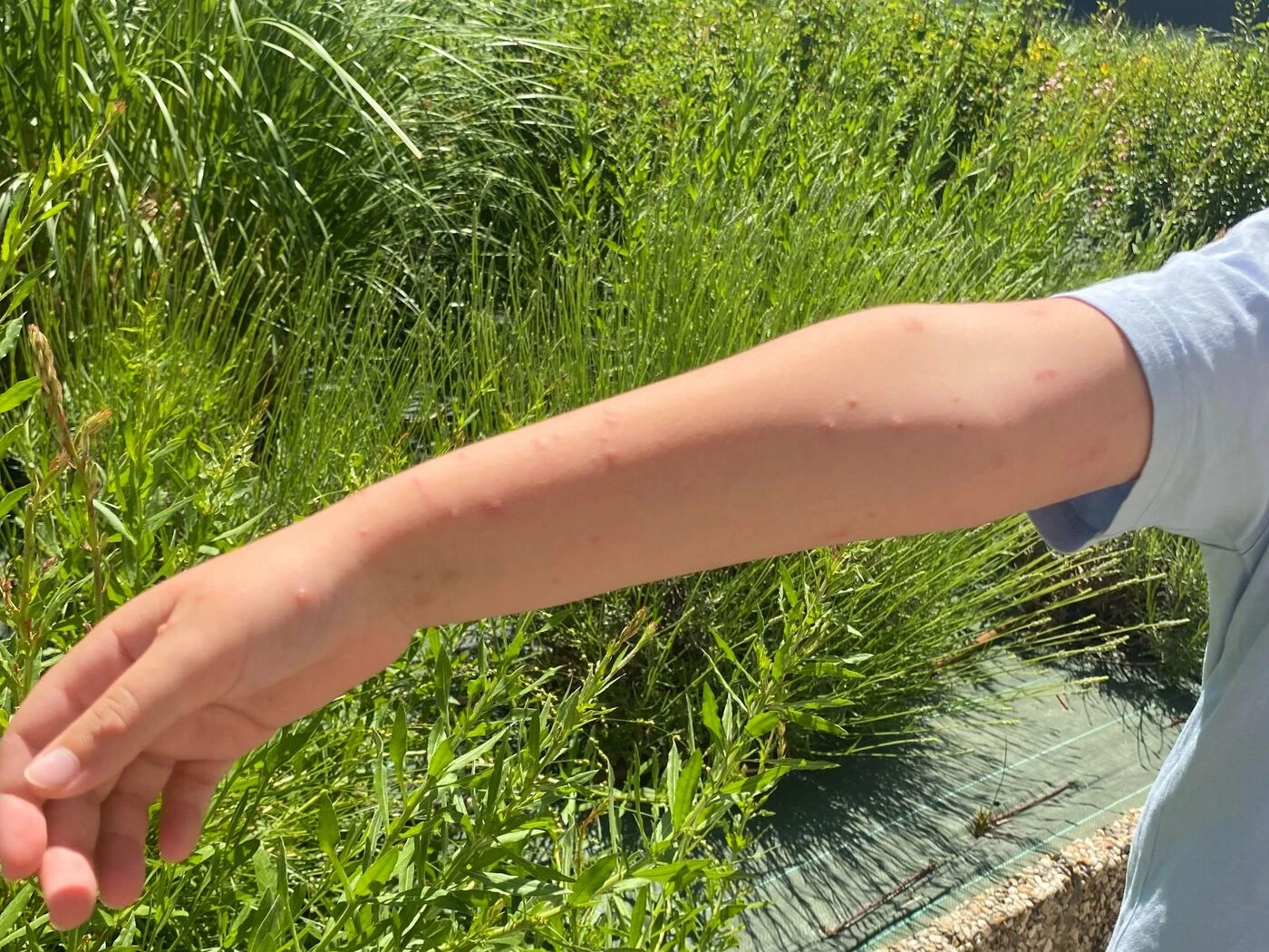 « Plus je gratte, plus ça les propage » : épidémie de boutons en Eure-et-Loir, les chenilles processionnaires du chêne mises en cause