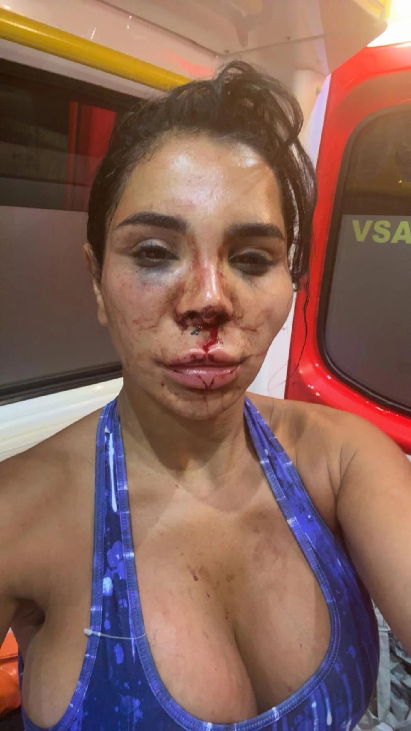Ligotée, aspergée d’eau de javel, violée : l’influenceuse Soraya victime d’un violent home-jacking à Marseille