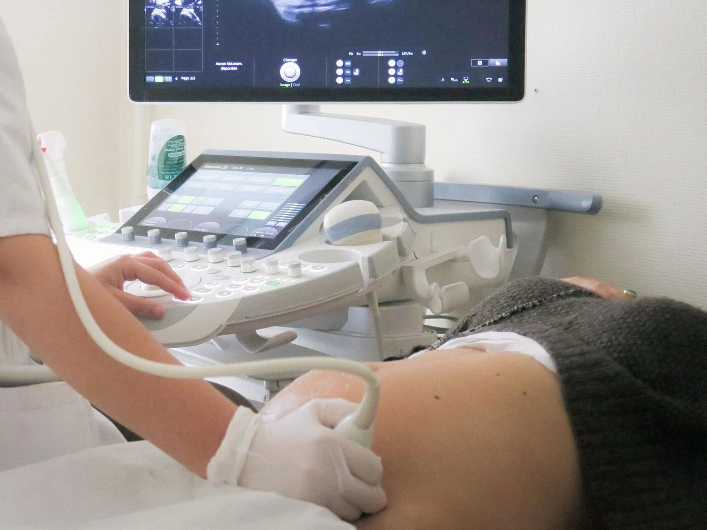 Une médecin ne décèle pas la trisomie 21 pendant une échographie, elle doit payer 300 000 d’indemnités aux parents