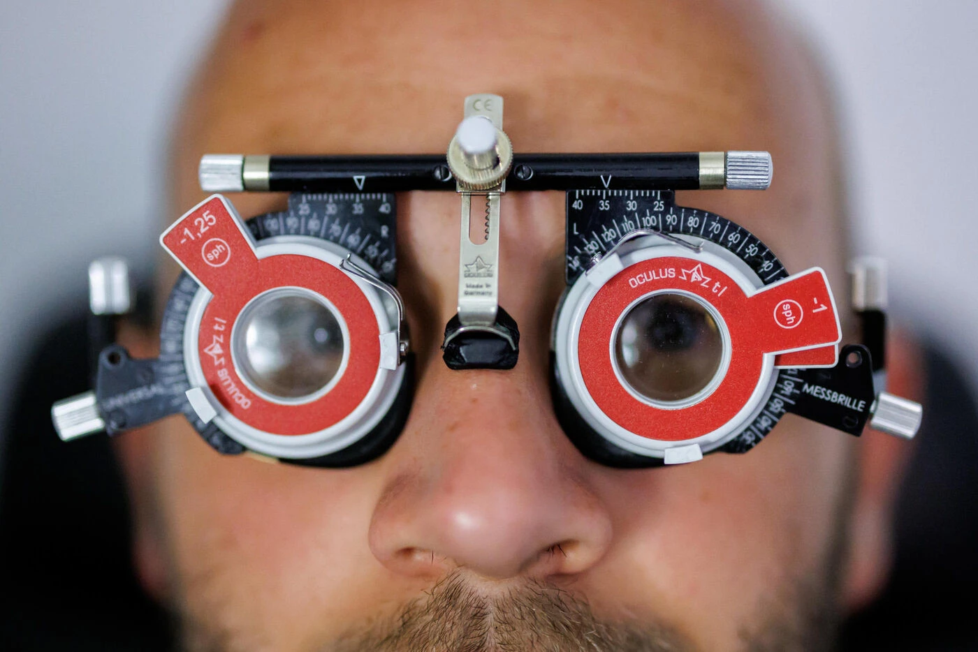 L’essor de la kérato-pigmentation, l’opération visant à changer la couleur des yeux, inquiète l’Académie de médecine
