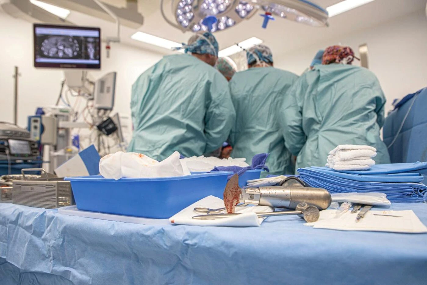 « Une découverte cruciale » : un patient chinois survit près de six mois grâce à un foie de porc génétiquement modifié