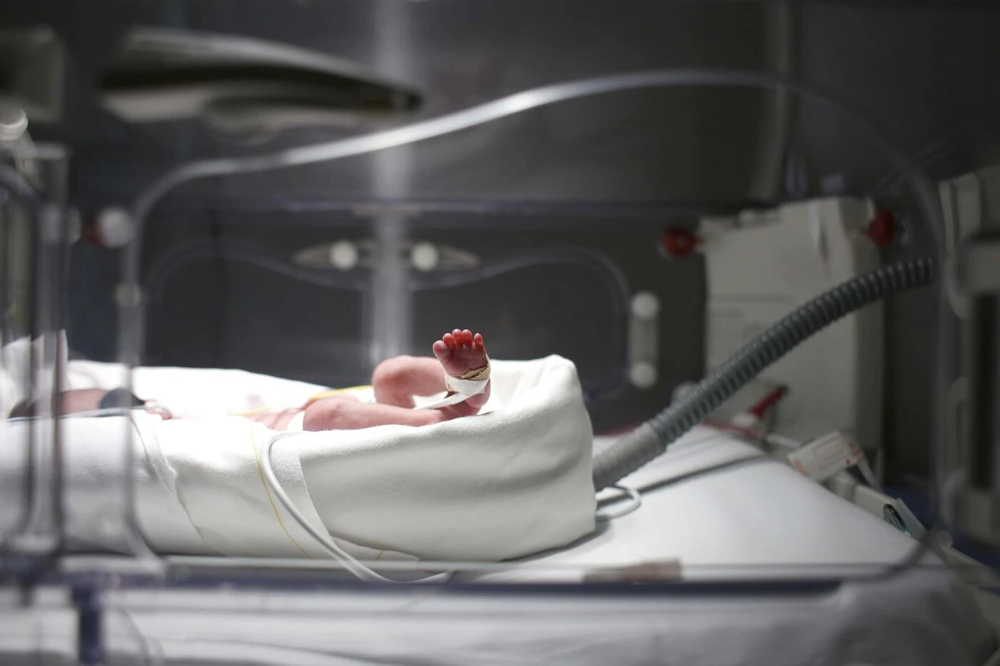 « Une petite sirène » : Eliana, un bébé prématuré, guérie d’une blessure grâce à une greffe de peau de poisson