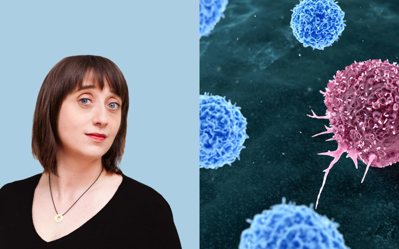DIRECT. Cancer : immunothérapie, traitement, symptômes… Posez-nous vos questions sur les progrès contre la maladie