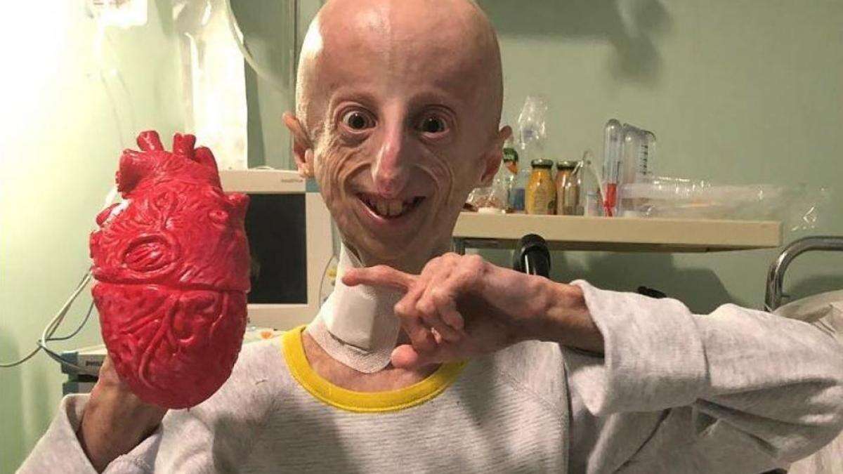 Hacen realidad el bonito deseo póstumo de Sammy Basso, la persona con progeria más longeva del mundo