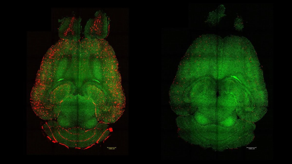 Logran revertir el alzheimer en ratones con solo tres inyecciones de nanopartículas