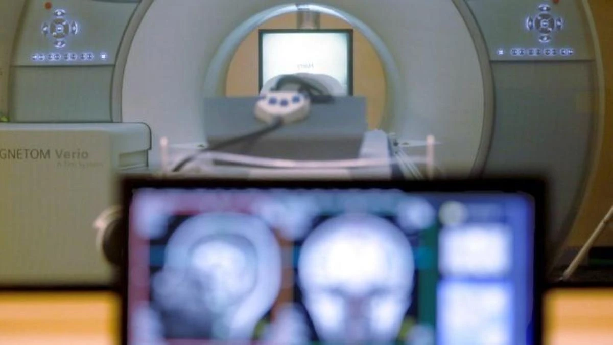 La alta tecnología en el estudio del cerebro