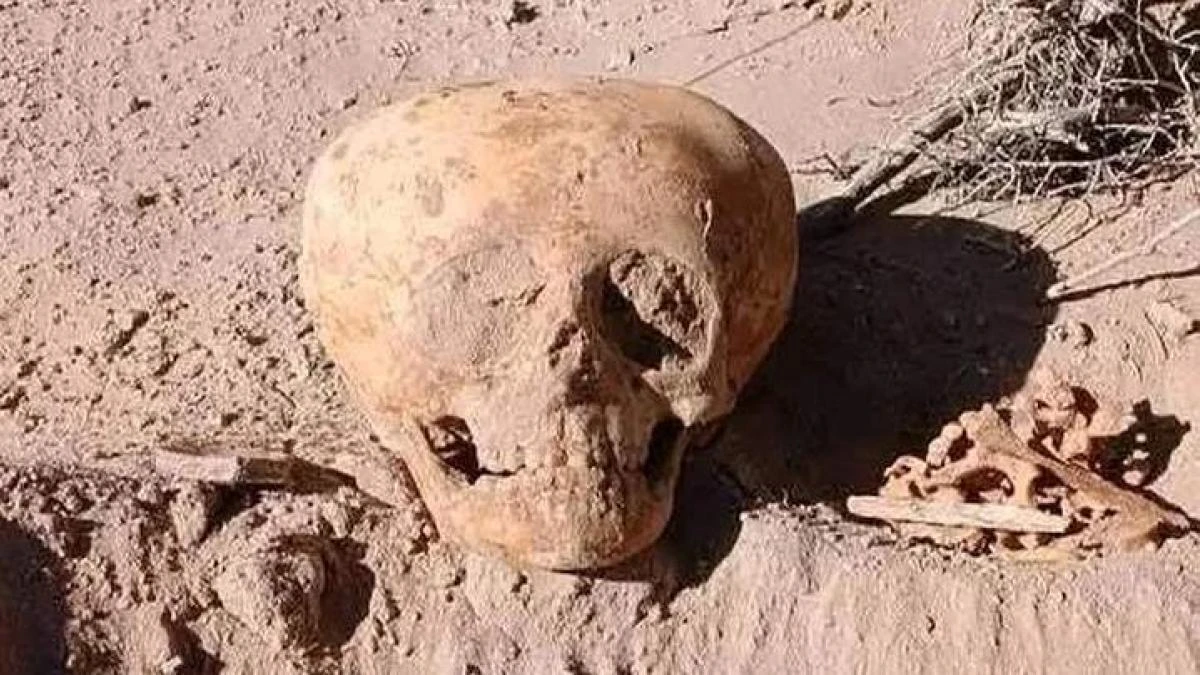 Unos trabajadores que hacían una conexión de agua hallan el cráneo deformado de un niño que vivió hace más de 700 años en Argentina