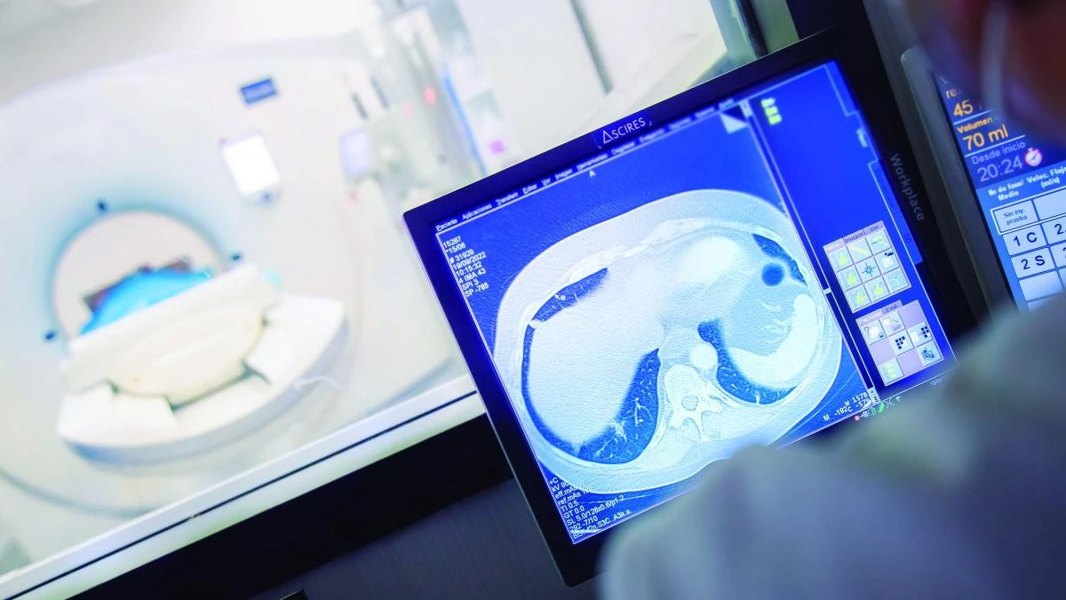 Cómo tratar enfermedades pulmonares a bajo cero sin necesidad de ir a la Antártida