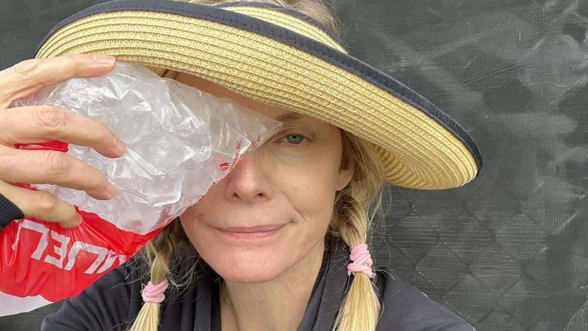 Michelle Pfeiffer muestra el moratón en su ojo tras un golpe en la cocina