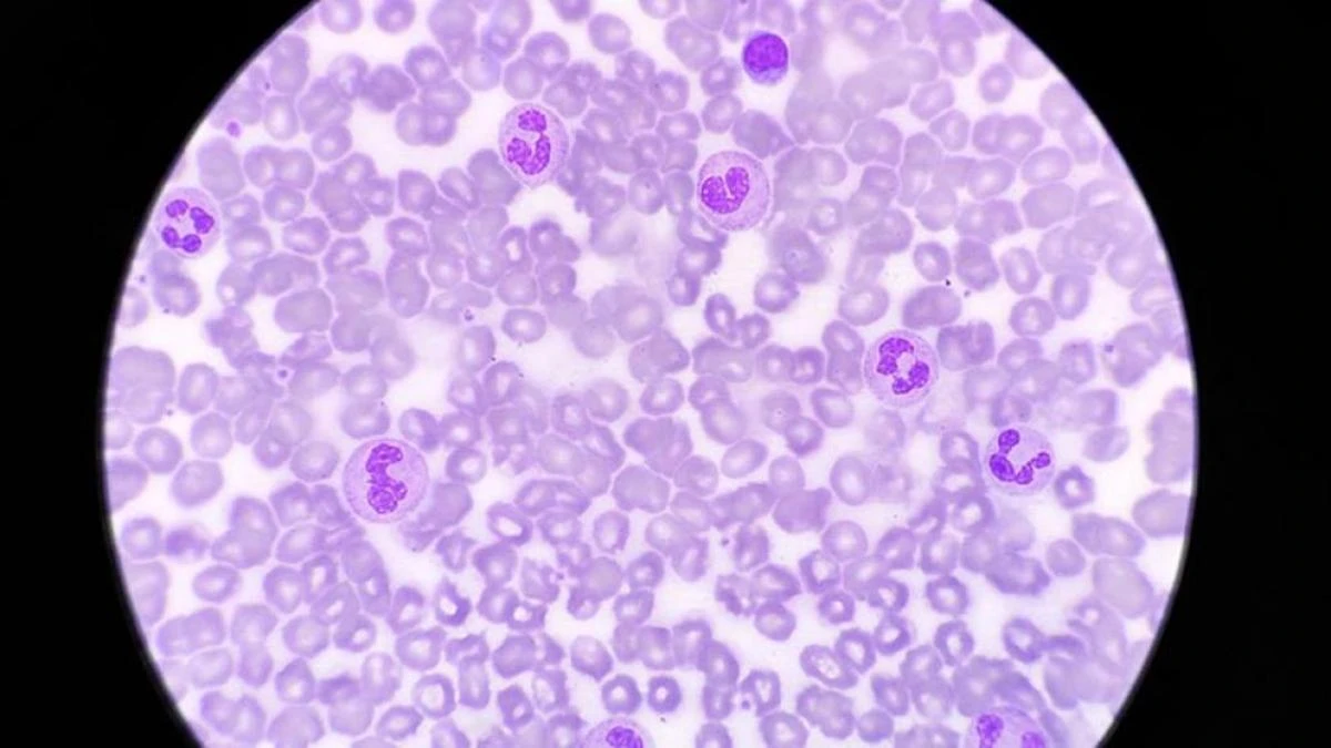 La luz del día puede aumentar la capacidad del sistema inmunológico para combatir infecciones