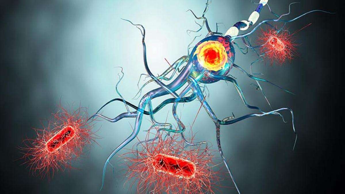 Esclerosis múltiple con síntomas y causas que es importante conocer