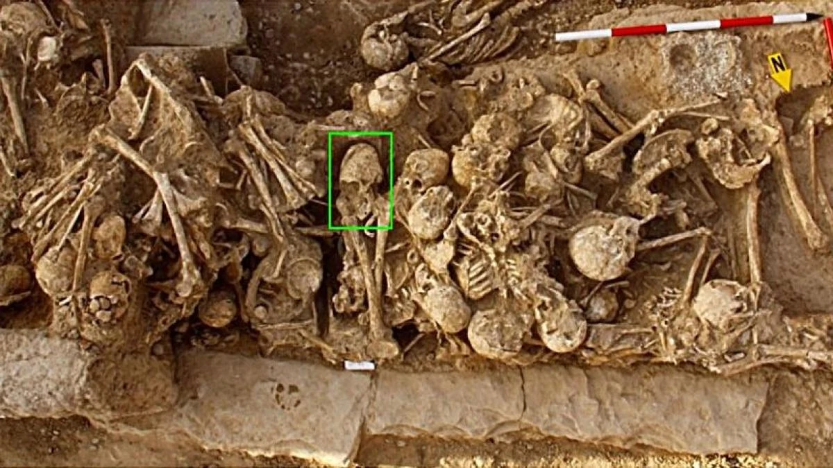Las extrañas circunstancias que provocaron la muerte a una joven con el cráneo deformado de forma intencional hace 6.200 años en Irán