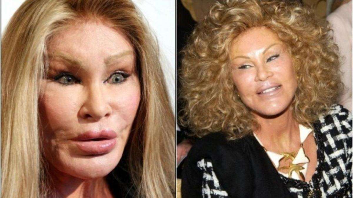 La adicta a la cirugía Jocelyn Wildenstein muestra su impresionante antes y después