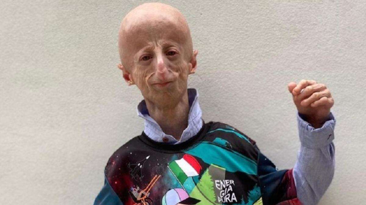 Muere a los 28 años Sammy Basso, la persona con progeria más longeva del mundo