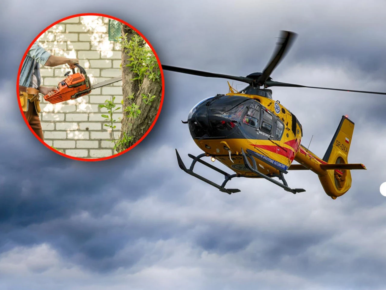 Służby w akcji Makabryczny wypadek w ogrodzie. 73‑latek rozciął sobie brzuch piłą!