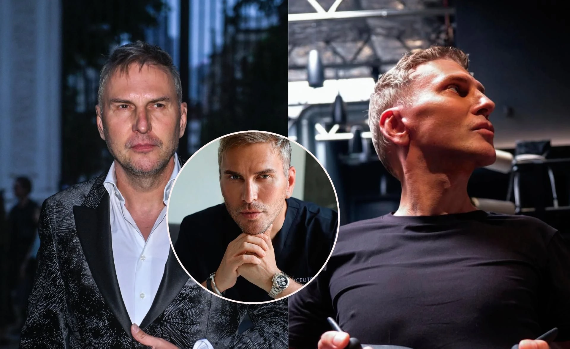 Poszedł pod nóż Nowa twarz Krzysztofa Gojdzia! Widzicie różnicę? Za nim poważne operacje warte 150 tys. zł. Wyciął powieki, zrobił lifting