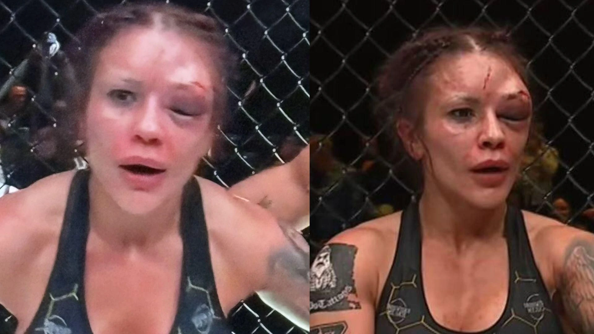 Drastyczne zdjęcia Zmasakrowana twarz zawodniczki PRIME MMA po walce. Porównali ją do... Joanny Jędrzej…