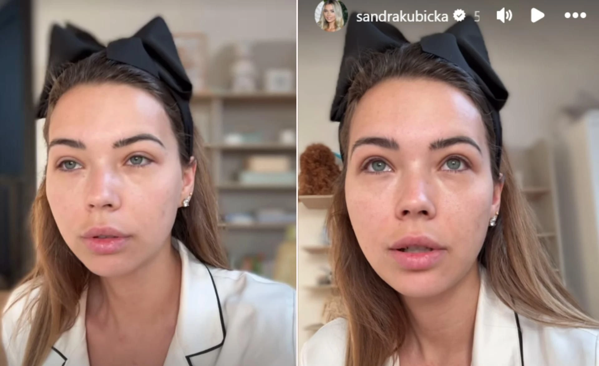 Walczyła o małżeństwo Sandra Kubicka z podkrążonymi oczami komentuje rozwód z Baronem. 