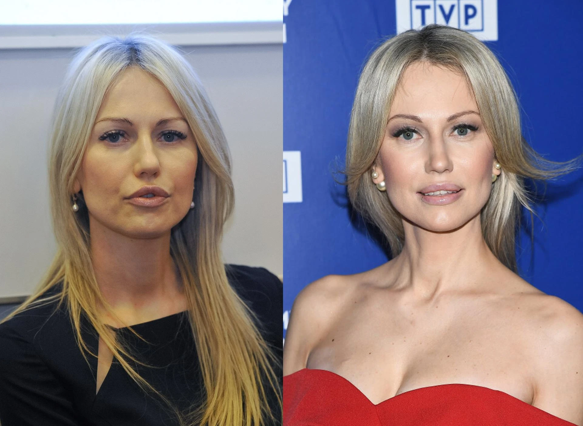 Tak naprawdę wygląda twarz Magdaleny Ogórek. W TVP tego nie widać. Zdjęcia bez ściemy