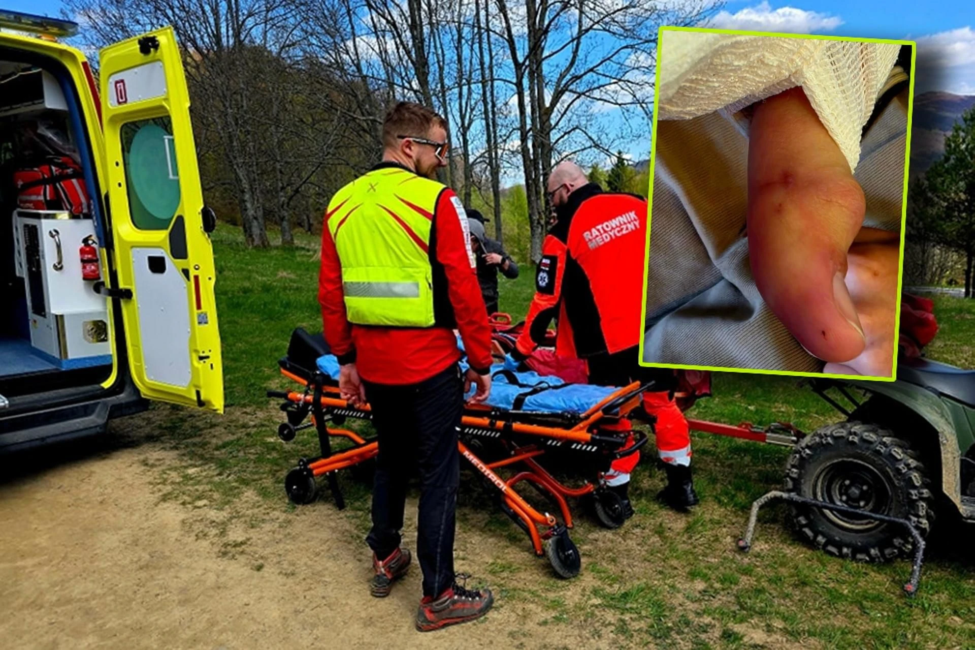 WAŻNE Co robić, gdy ukąsi żmija? Ratownicy przed majówką przypominają o zagrożeniach