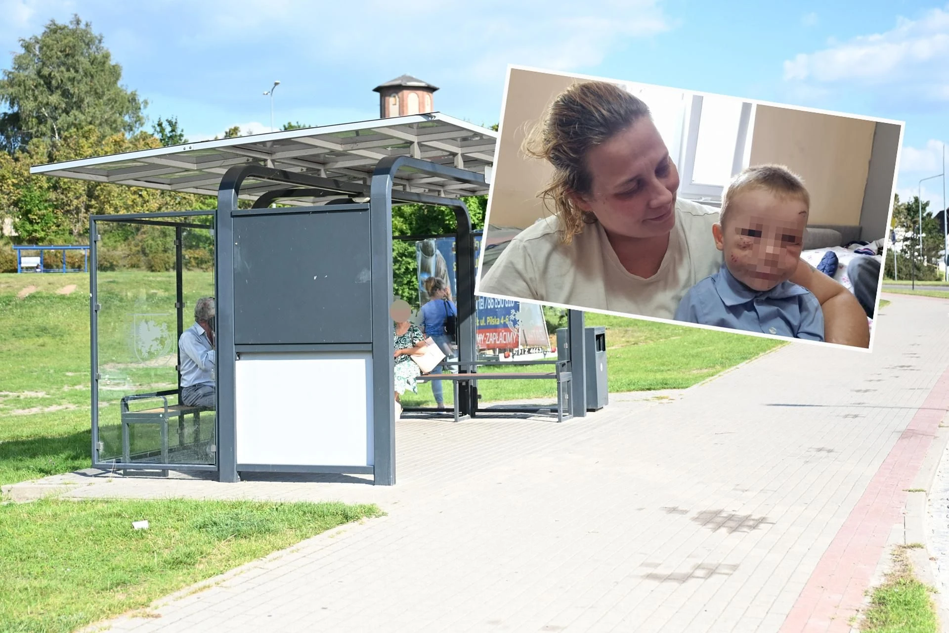 Przerażające! Pies pogryzł 3-letniego Darka na przystanku! Porażający widok na buzi dziecka
