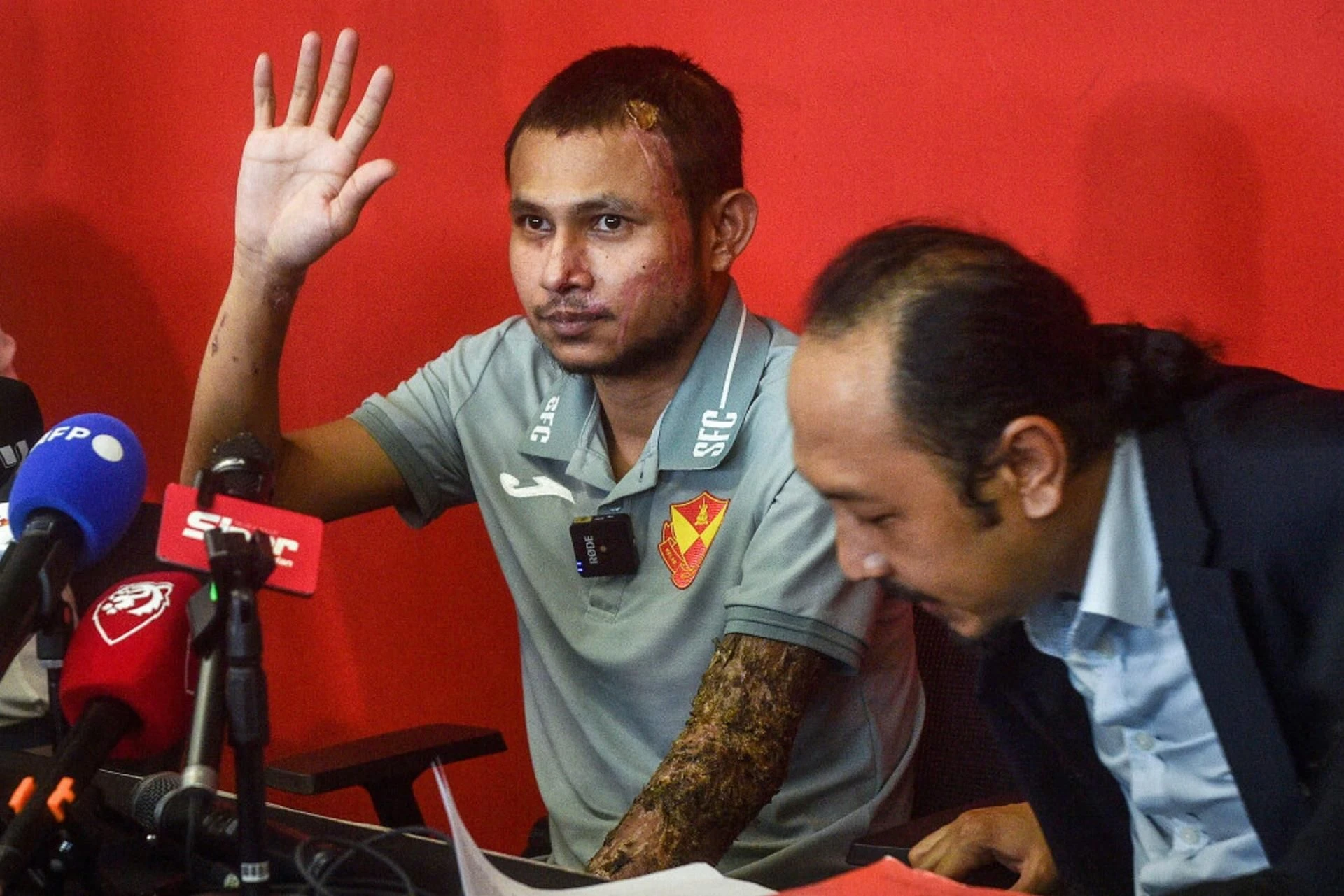 Niezwykła historia w świecie futbolu Reprezentacyjny piłkarz został oblany kwasem. Doznał oparzeń czwartego stopnia, ale …