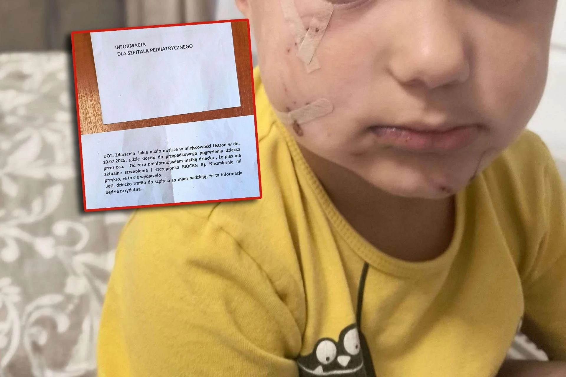 Nowe informacje Pies pogryzł 4-letniego Franka. Zarzuty dla właściciela