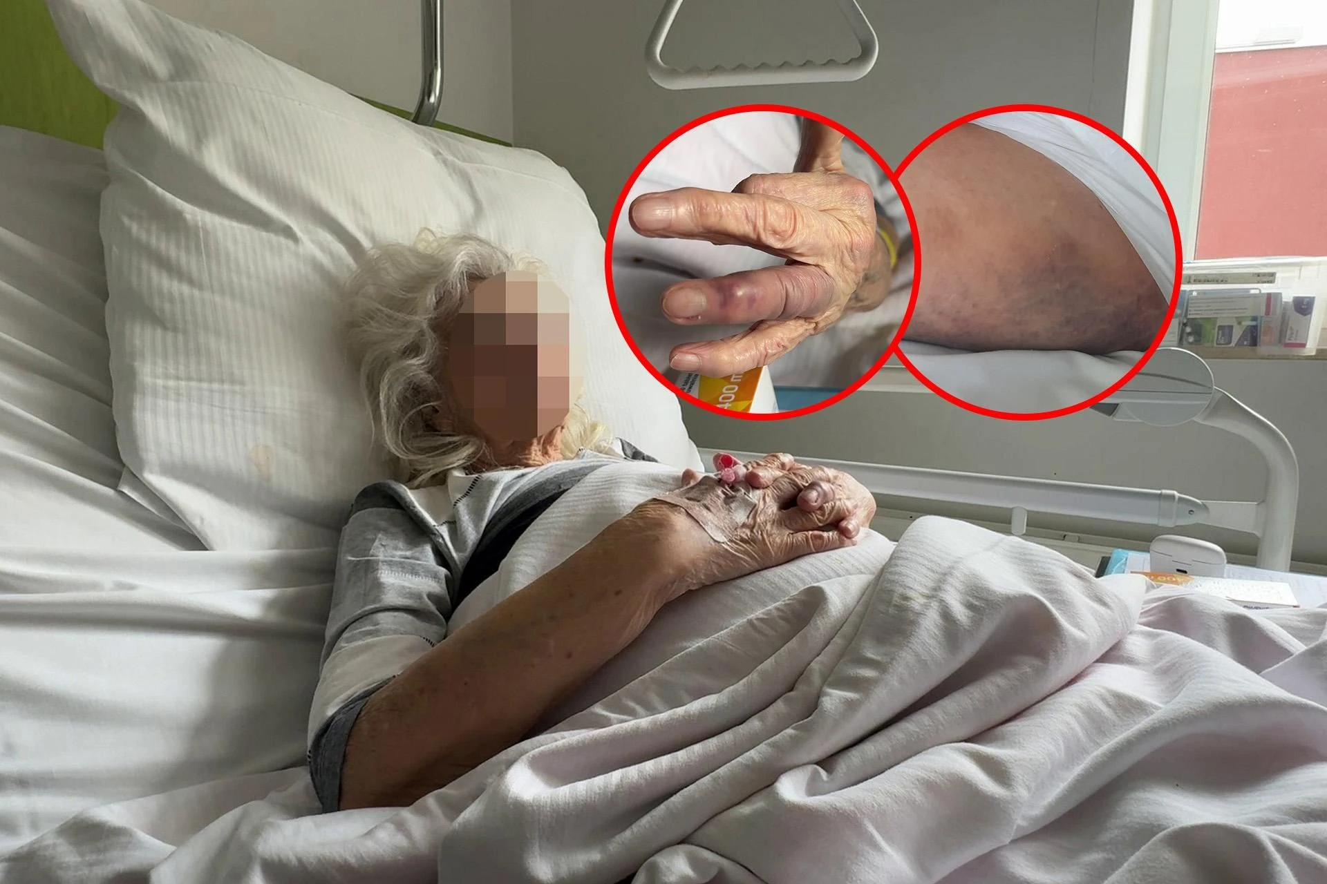 DRAMATYCZNY ROZBÓJ 92-letnia Maria ofiarą bestialskiego ataku. „Zrujnował jej starość za 300 zł”