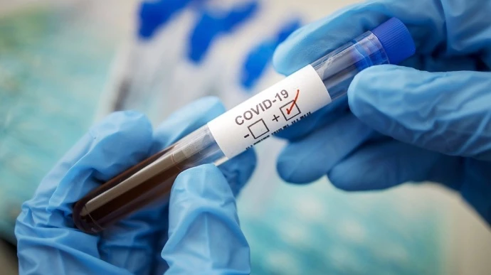 COVID-19 не відступає: у Британії добовий рекорд захворюваності