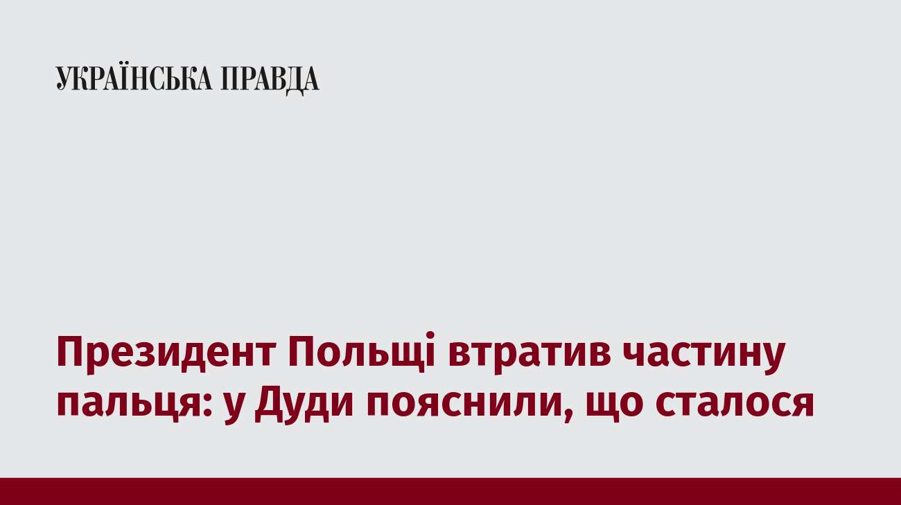 Президент Польщі втратив частину пальця: у Дуди пояснили, що сталося