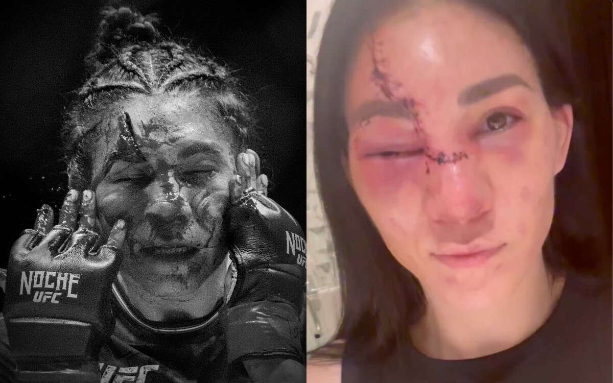 ‘Otro día en la oficina’: Irene Aldana ya se recupera tras corte en pelea de UFC