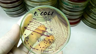 E.coli, listeria, salmonelles… Quelles sont ces bactéries qui peuvent dangereusement contaminer nos aliments ?