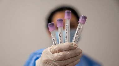 Hantavirus : symptômes, mortalité, quarantaine… L'infectiologue Anne-Claude Crémieux dresse le bilan de la situation