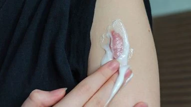 Vers la suppression définitive des cicatrices grâce à une simple crème ?