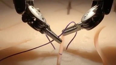 Un robot chirurgien dopé à l'IA réalise la première opération complexe sans intervention humaine