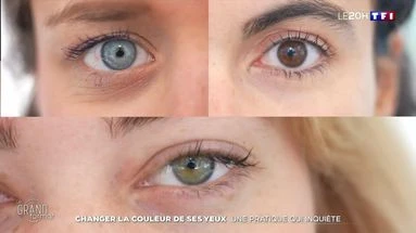 Changer la couleur de ses yeux : une pratique qui inquiète