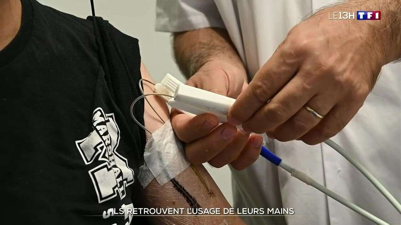 Ils retrouvent l'usage de leurs mains