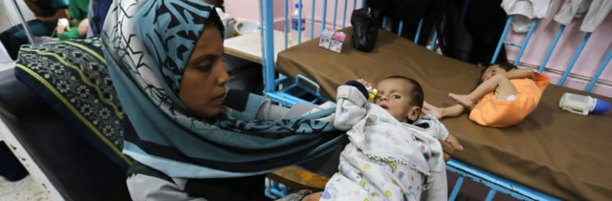 Des organisations humanitaires alertent sur la malnutrition infantile à Gaza