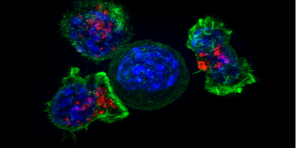 ¿Qué tienen en común una célula tumoral cultivada con la de un cáncer? Muy poco