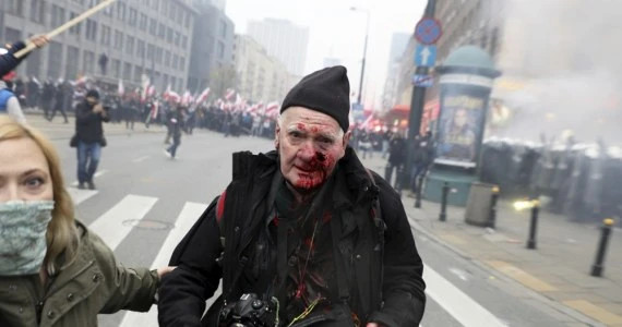 Fotoreporter poważnie raniony na Marszu Niepodległości. Policja: 