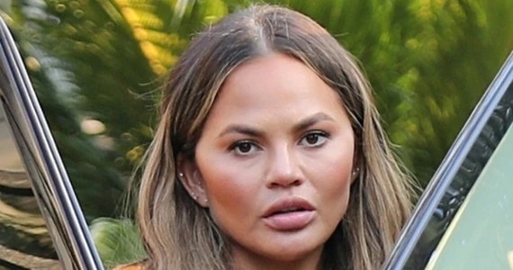 ​Chrissy Teigen wyjawiła sekret swojej nieskazitelnej cery. Jest nim olejek śliwkowy
