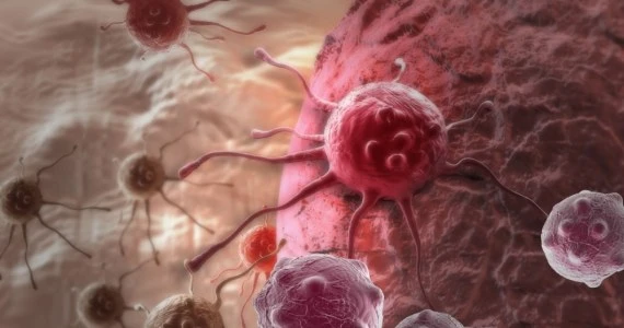 Chorzy na raka leczeni na czuja. Wiele błędnych diagnoz